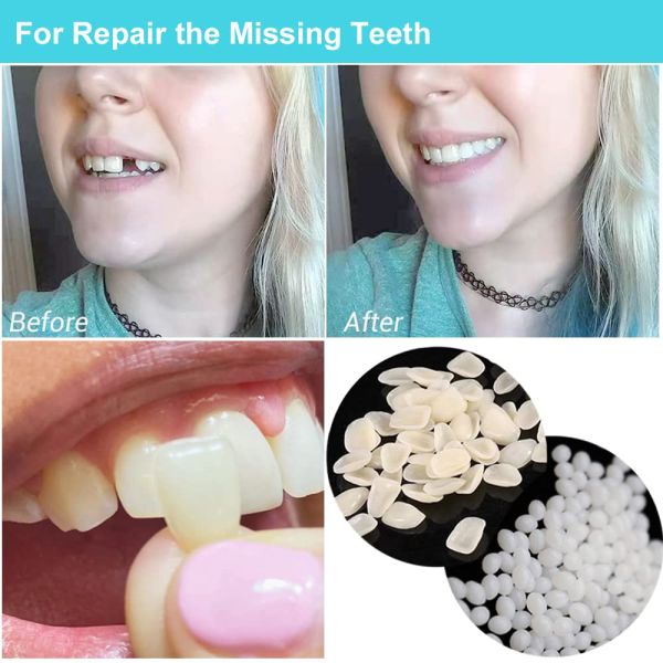 OEM Moldable Fake Teeth Tooth Repair Kit , Quick Fix Broken Tooth Repair Kit