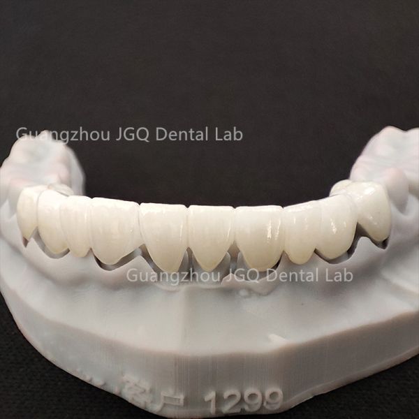 Bulk Zirconia Restorations China Dental Lab Outsourcing Partner