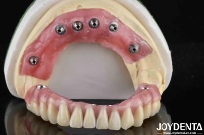 Translucent Ti-Base Acrylic Teeth Finish for Dental Laboratory Production