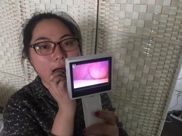 ENT Scope Digital Video Otoscope Rhinoscope Laryngoscope Medical Endoscope