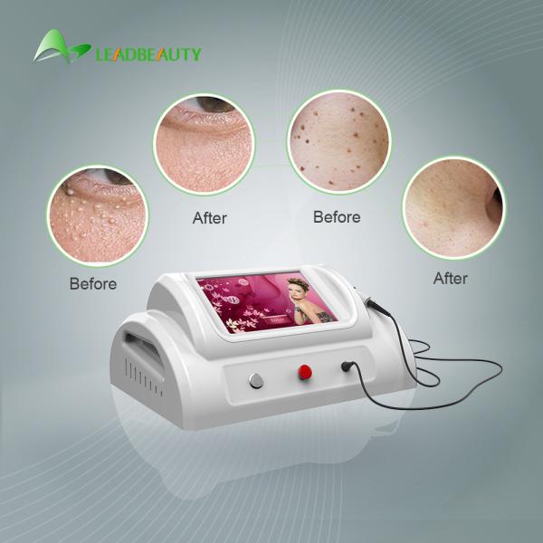 30Mhz high frequency Spider Vein removal price / using for vascular removal with 8.4 inch screen /150W skin tag removal