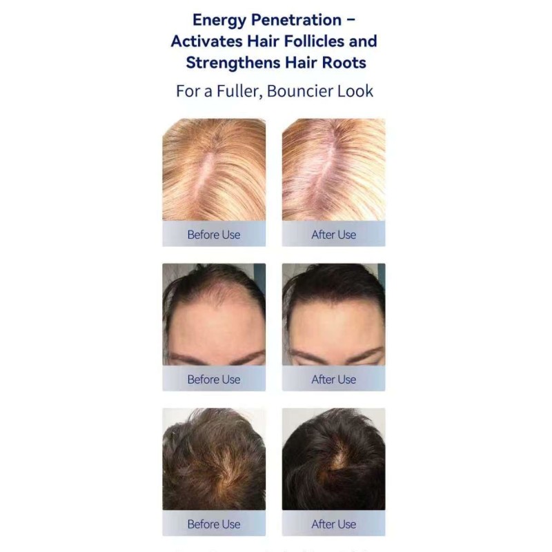 82pcs Red Light Anti Hair Loss Scalp Treatment 660nm 850nm LED Hair Growth Caps