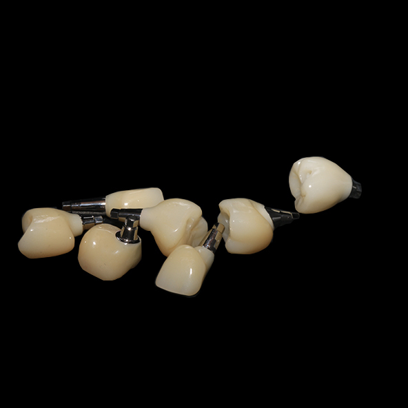 Silver Custom Titanium Abutments Dental Implants With Full Zirconia Crown