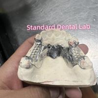 Quadro fundido de cromo de cobalto dentadura parcial Vitallium 2000