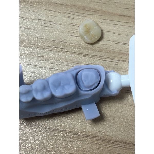 Full Zirconia Crown - High Strength Biocompatible Dental Crown for Durability