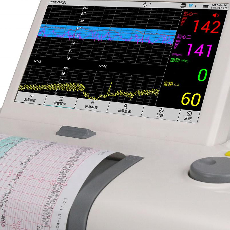 Durable Necessary Hospital Pregnant Women NST Cardiotocography Machine Ctg Machine Maternal Fetal Monitor For Baby Heartbeat