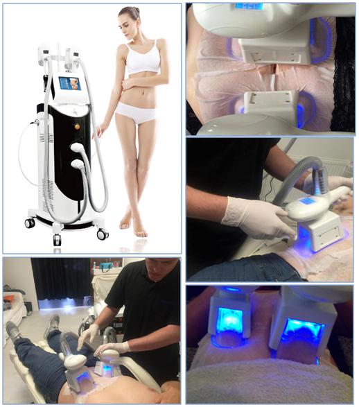 Fat Freezing Medical Cryolipolysis Machine For Face / Body Shaping And Lifting