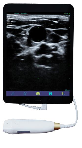 Hot Sale Smart USB Convex Medical Doppler Ultrasound Scanner Ultrasound Probe