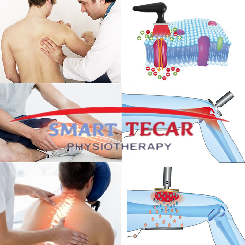 Портативная машина терапией Tecar диатермии для растяжения Plantar Fasciitis лодыжки Injuiry спорта