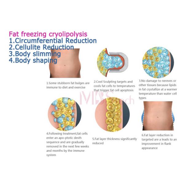 CE Rohs Weight Loss Body EMShapeing Cryolipolysis Machine