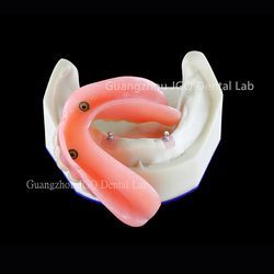 High Precise Ball Attachment Dentures China Dental Lab Customized