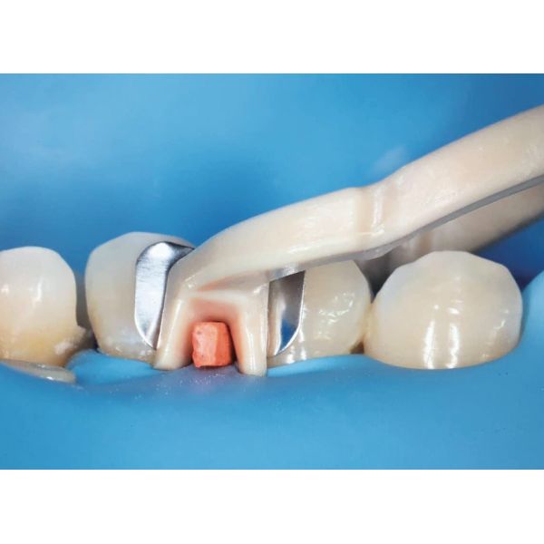 Dentistry Dental Sectional Matrix System Composite Clamp Ring R3