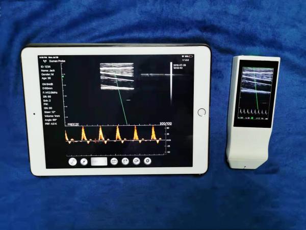 Wireless Linear Array Ultrasound Probe Handheld Wifi Ultrasound Scanner Price for Sale