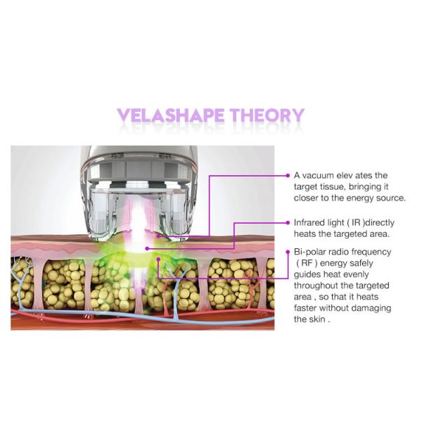 20MHZ 100kPa 940nm Vacuum Roller Slimming Machine