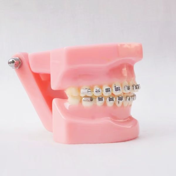 Dental Typedont Dentes Modelo Para Preparação Dental Estudante Ortodontia Prática Modelo