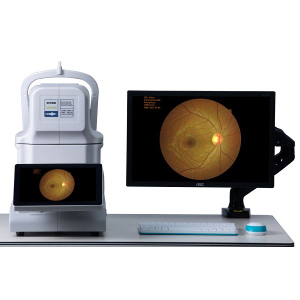 Размер зрачка камеры 2.8mm Fundus DICOM AI 240v не Mydriatic