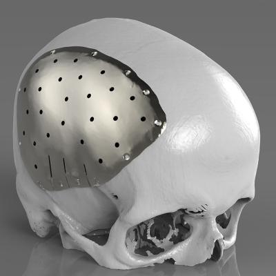 Customized Direct Digital Manufacturing 3D Printing Metal Stainless S136 and Aluminum Alsi10mg for Concept Models