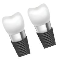 Biocompatibility e segurança de barras do implante dental
