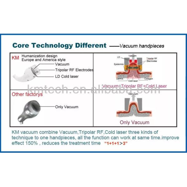 Переносная радиочастотная машина для похудения AU Plugs Ультразвуковая машина для кавитации жира