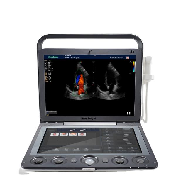 Portable 3D 4D Color Doppler USG&Sonoscape S9
