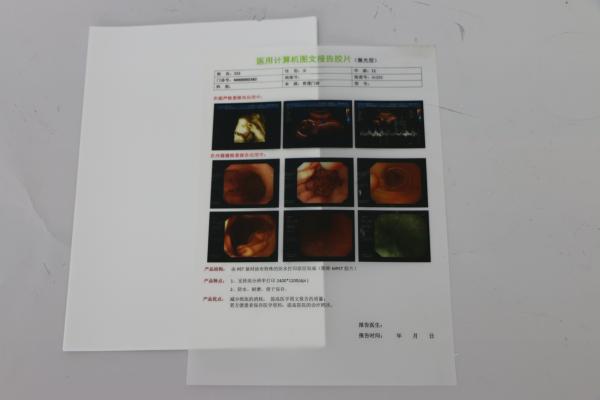 8x10 Inch 14x17 Inch Medical X Ray Film MRI PET CT Scan Films