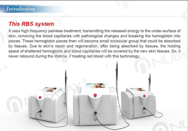 Painless safety high frequency 30MHZ spider vein removal and varicose vein treatment