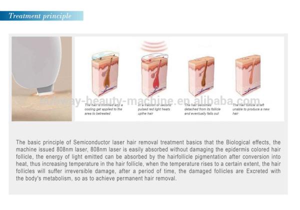 2018 hottest Beijing Nubway effective 2000W high power skin tightening 808nm diode laser hair removal machine for sale