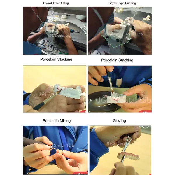 Dental Lab Durability Implants Make Cost-Effective Option in The Long Run