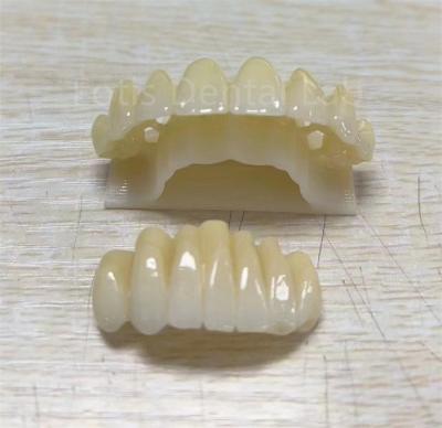 Precision Zirconia Multilayer Product For Improving Fracture Resistance