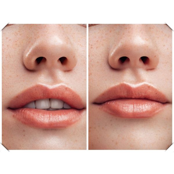 Лучший Juvederm Ultra 3 для увеличения объема губ Dermal Injection Filler Гиалуроновая кислота
