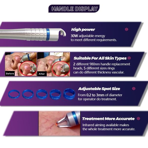 Диод ноги 980nm портативной васкулярной машины удаления вены паука лазера 30w лицевой