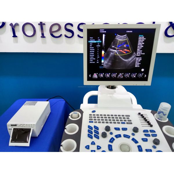 4D Color Doppler Ultrasound Machine Obstetrics And Gynecology Equipment Hospital