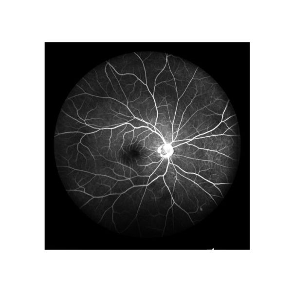 Equipo oftálmico de Angiograph Digital 160° de la retina