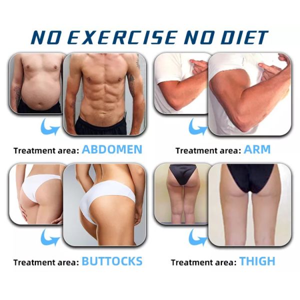 Body Sculpting  Neo Machine 4 Handles Inewtech