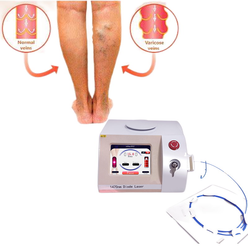 Big power 1470nm diode laser vascular removal  venoclisis laser evlt lipolysis