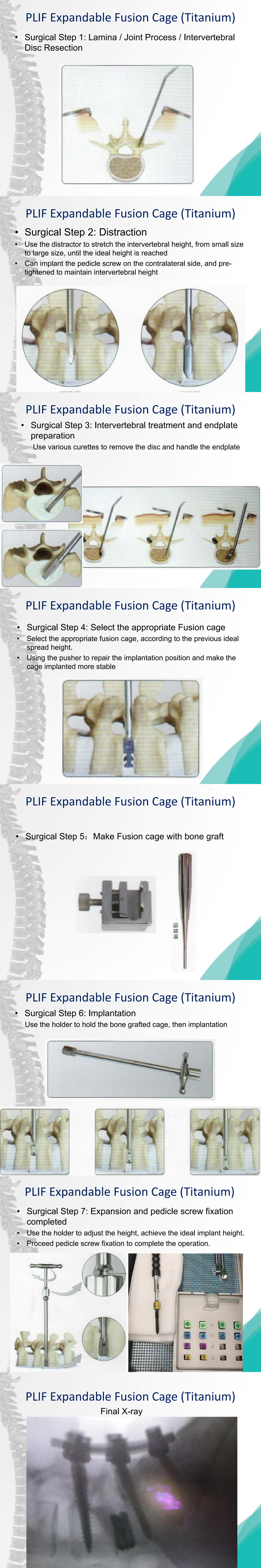 OEM Expandable PLIF Cage Spinal Surgery Expandable Titanium Cage CE