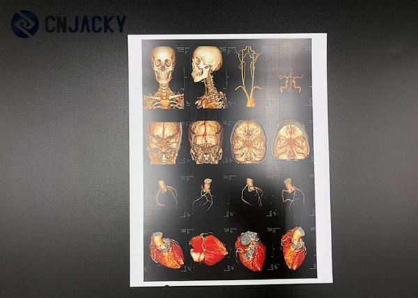 0.15mm Medical Radiation Printing Film