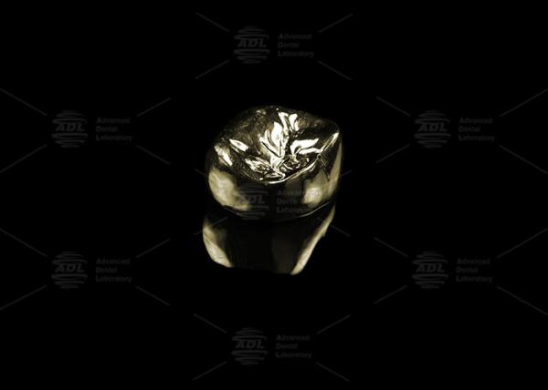Sleek Full Cast Metal Crown Precious Alloy Gold 20% Polished Full Metal Dental Crown