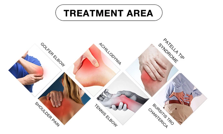 Máquina capacitiva y de la resistencia del RF de la belleza del equipo el ccsme de la onda de choque