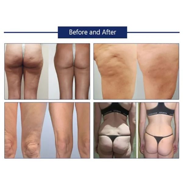 Женские электрические красивые Boobs усиливающего агента заботят Massager груди горячей большой машины увеличения груди вибрируя