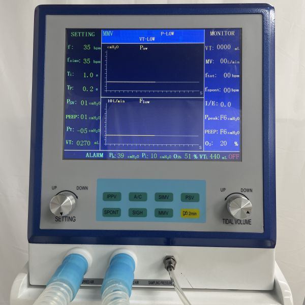 ИСО9001 Мобильная дыхательная машина ИВЛ Портативный больничный Ику Вентилятор