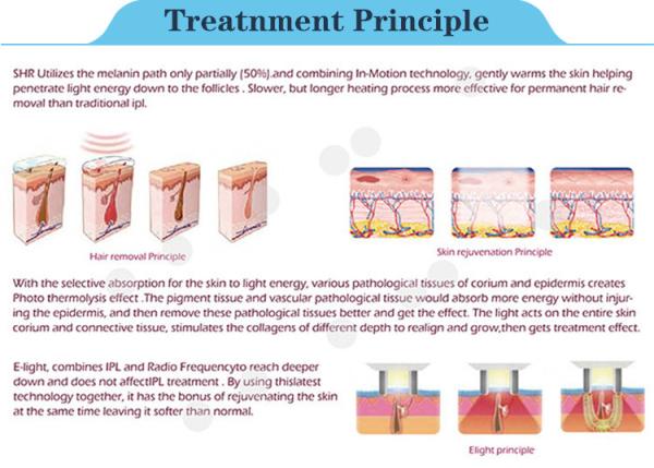 2017 New Arrival Two Handles IPL SHR Hair Removal/Skin Rejuvenation System NBW-SHR212