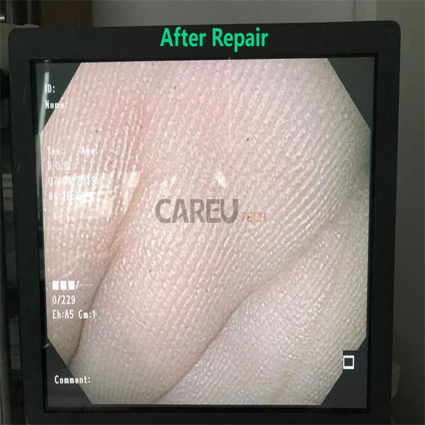 Repaired Olympus Medical Equipment Ultimate Solution For Medical Services