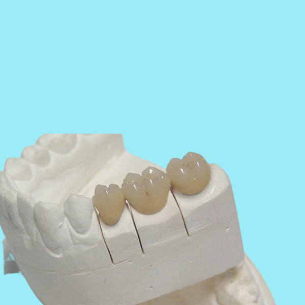 Временная крона 3D CAD/CAM PFM зубоврачебная печатая изготовление на заказ Denture дизайна