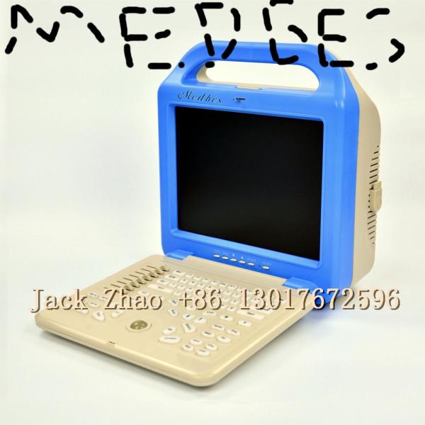 Medbes Portable Ultrasound Machine for Human Being