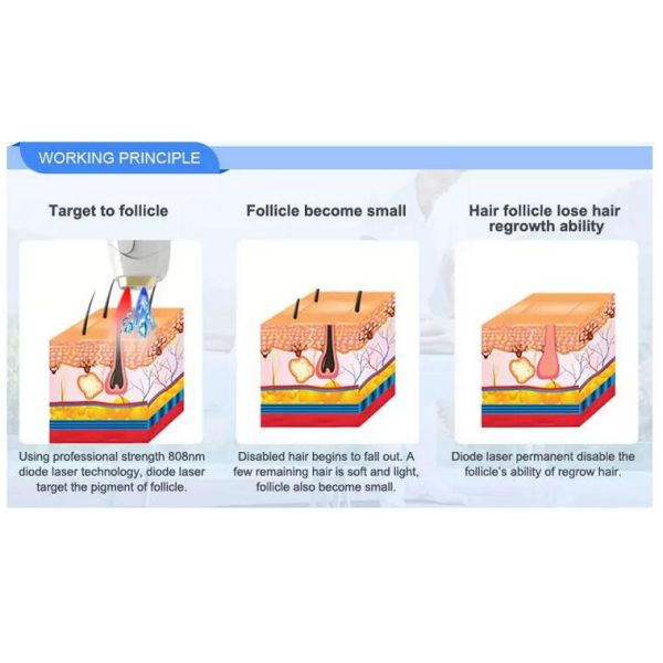 Non Channel Diode Laser Hair Removal Machine , Alexandrite Laser Hair Removal Device