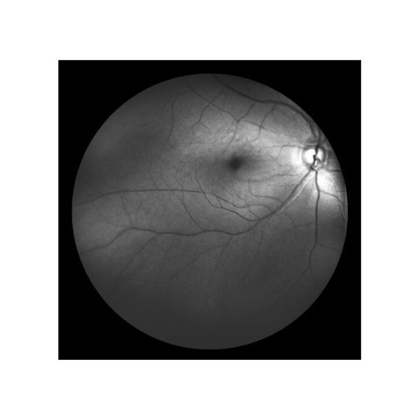 Equipo oftálmico de Angiograph Digital 160° de la retina