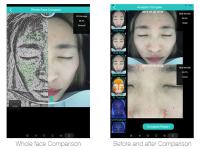 Doctor los analizadores del hogar de la cara de Use 3D con 30 millones de bases de datos clínicas