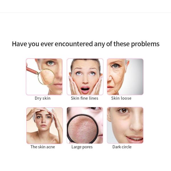 Face Target Area BBface Small Molecule Non-invasive No Needle Thread Lift EU Plugs Type