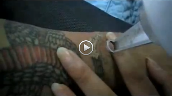 Painless Nd Yag Q-Switched Laser For Tattoo Removal Equipment 1000mj Pulse Energy